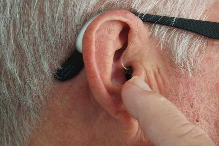 noise induced hearing loss